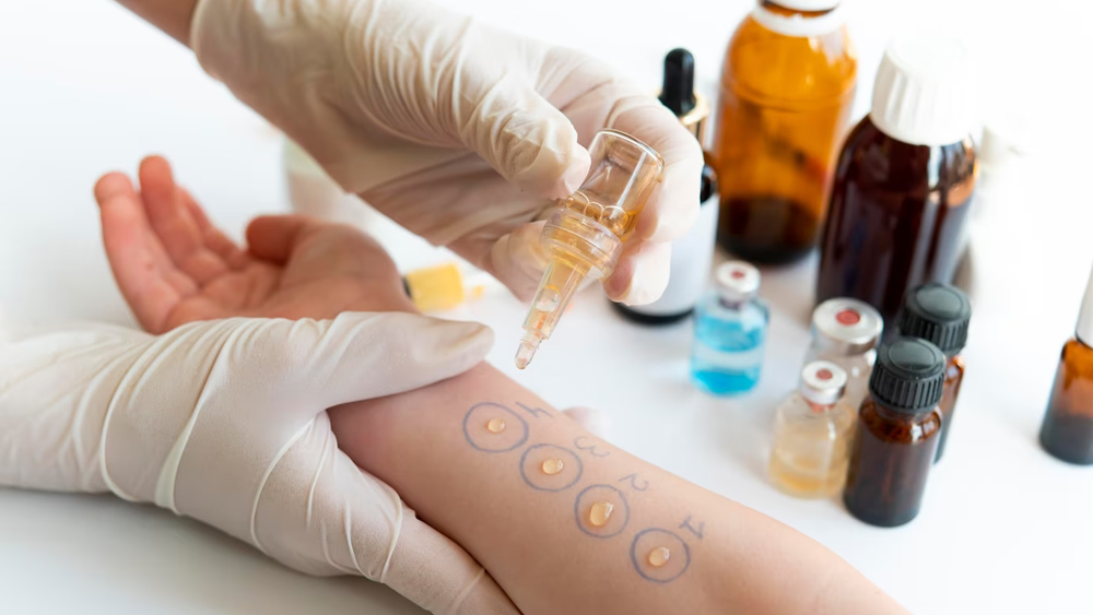 vacunas antialergicas farmacia rocafort